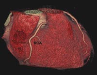 Fig1-A