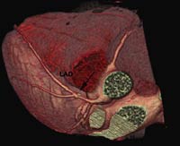 Fig2-A