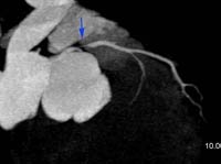 Fig3-A