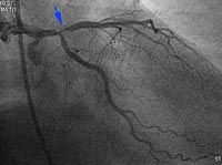 Fig3-C